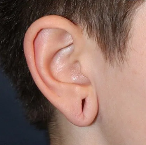 before treatment