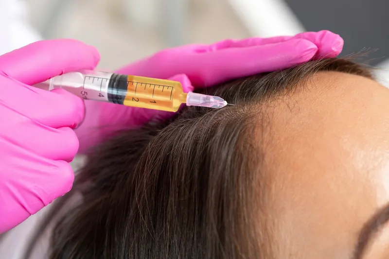 PRP for Hair