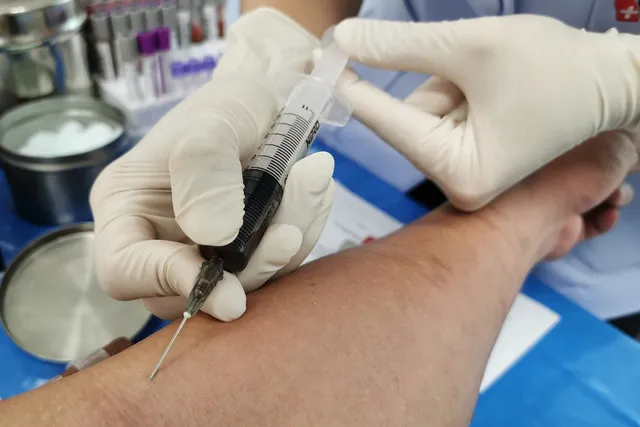 Stem Cell Therapy